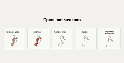 Избавление от грибка (микоза) стопы — Центре подологии СТОПАМЕР