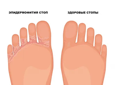 Грибовидный микоз. Учебно-методическое пособие для врачей, , Бином купить  книгу 978-5-9518-0705-2 – Лавка Бабуин, Киев, Украина