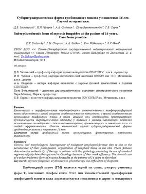 Микоз кожи стоп, ногтей, головы, рук | Лечение микоза у ребенка и взрослого  в Клинике подологии Полёт в Москве