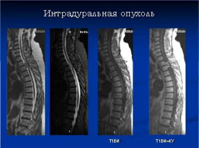 МРТ грудного отдела - Отделение КТ и МРТ НИИ СП им. Н.В. Склифосовского