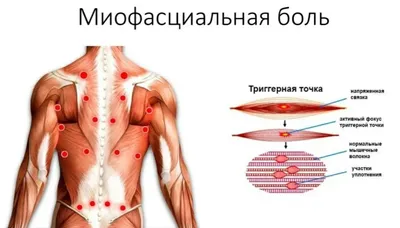 Слабая шея, плохое кровоснабжение мозга? Значит, слабый, разболтанный грудной  отдел позвоночника. Какие нужны упражнения? | Причины Здоровья | Дзен