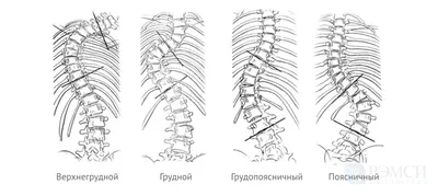 Fit.Shamova - ✓Продолжим тему грудного отдела позвоночника . ✓Если у вас  зажат грудной отдел позвоночника вы не сможете: 📌 правильно дышать  📌выполнять жимы 📌выполнять тяги, особенно сверху 📌во время приседаний и  выпадов