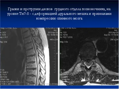 Анатомия и физиология позвоночника