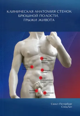 Грыжи: причины, лечение и профилактика