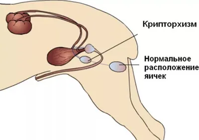 Крипторхизм (и речь сейчас не про крипту)