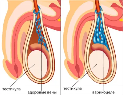 Как регулярные осмотры у детского уролога-андролога помогут избежать  серьезных проблем со здоровьем? » Новости Ижевска и Удмуртии, новости  России и мира – на сайте Ижлайф все актуальные новости за сегодня