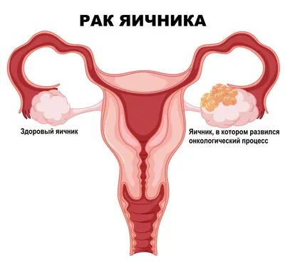 Яичники. Большая российская энциклопедия