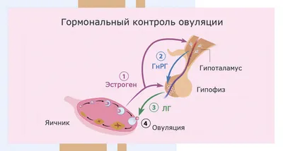 Киста яичников (лапароскопия яичников, удаление кисты яичников)