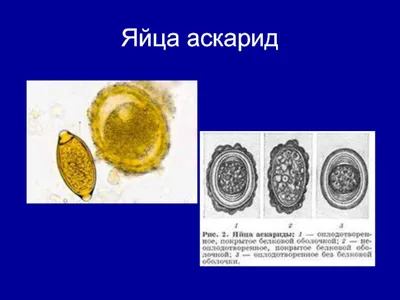 Яйцо аскариды рисунок - 93 фото