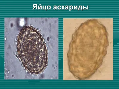 Человеческая Аскарида Яйца В Кале Под Микроскопом Фотография, картинки,  изображения и сток-фотография без роялти. Image 73640135