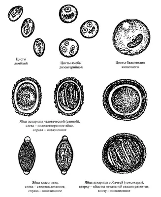 АСКАРИДА ЧЕЛОВЕЧЕСКАЯ, Ascaris lumbricoides – геогельминт, воз¬будитель  аскар