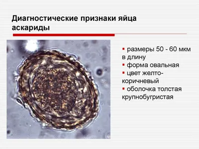 Аскариды у детей — почему появляются, как выявить и чем выводить