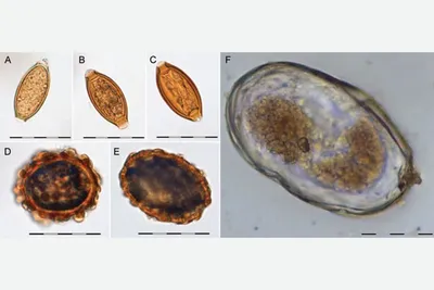 Ученые обнаружили яйца глистов в туалетах викингов - Газета.Ru | Новости