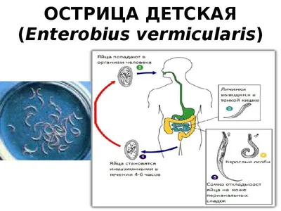 Заразиться острицами легко! | Ганцавіцкі час