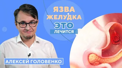 Острая язва, язвенная болезнь желудка и призыв в армию | Пикабу