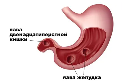 Язва желудка. Клинический случай - рассказываем в блоге ТерраВЕТ - клиника  24/7