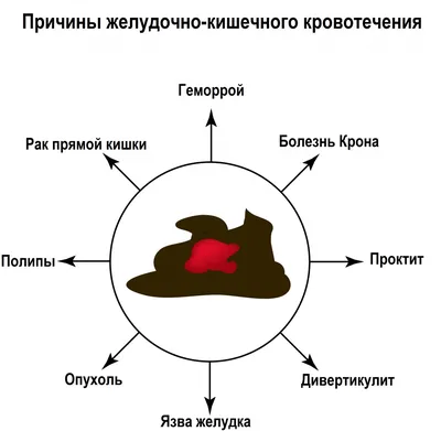 Диета при язве желудка: что можно, что нельзя, меню на неделю