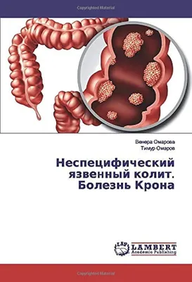 Болезнь Крона и язвенный колит » Bioloji Təbabət Klinikası