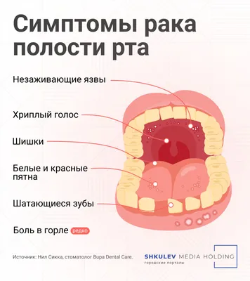 Герпетический стоматит 【причины, симптомы и лечение】