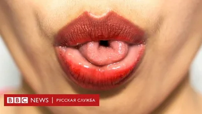 Что означает белый налет на языке