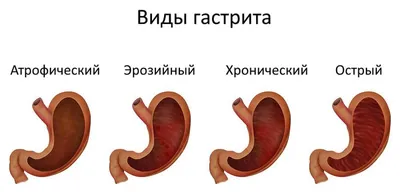 Какие заболевания можно определить по состоянию языка — Здоровье