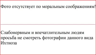 Эмульсия для тела LIPOBASE (ЛИПОБЕЙЗ) - «Эту эмульсию рекомендовал  дерматолог при ихтиозе у ребёнка » | отзывы