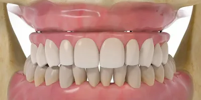 Имплантация зубов в Курске: цены на имплантацию зубов в стоматологии Doctor  Smile