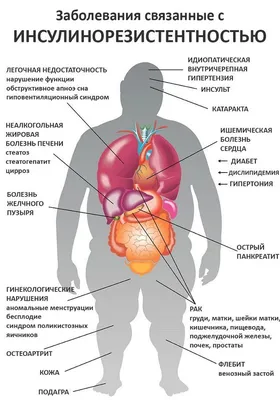 Инсулинорезистентность, диагностика и лечение в Екатеринбурге — Семейная  Клиника