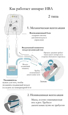 Аппарат искусственной вентиляции легких превратился в самое важное  оборудование во время пандемии COVID-19