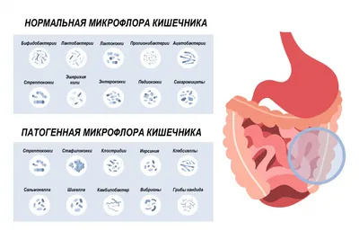 Важный анализ для ранней диагностики колоректального рака | Лабораторная  диагностика: реальные истории, интересные факты | Дзен