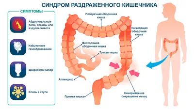 Как уберечь кишечник от 15 кг каловых камней: подробная инструкция | Худей  назло диетам | Дзен