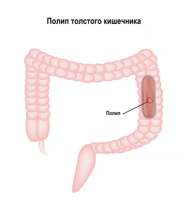 Онко Вики — Как устроен кишечник?