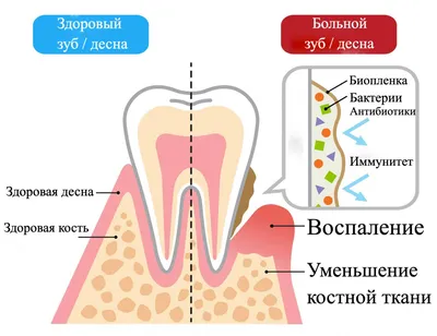 Чистка зубов собаке и кошке удаление камня