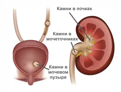 Камни в почках мочевом желчном пузыре АЛТАЙ таежная лавка для растворения  камней 125 г - купить в ИП Мелехова, цена на Мегамаркет