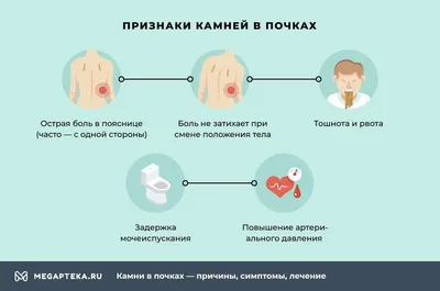 Контактная литотрипсия (дробление) камней почек, мочеточника и мочевого  пузыря