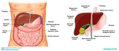 Жёлчные камни — Википедия