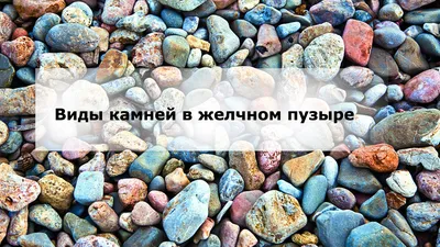 Лечение камней в желчном пузыре без операции, препараты для растворения.