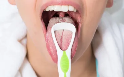 Почему возникают заеды в уголках рта?👄 | Аптеки Вита | Дзен