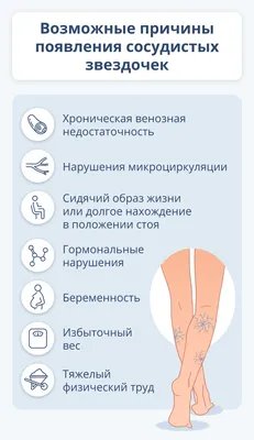 Лопаются сосуды на ногах: что это, причины, как бороться - 7Дней.ру