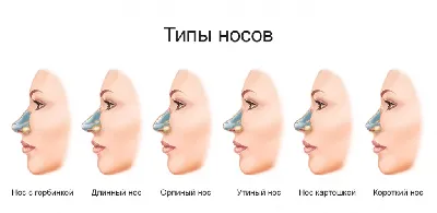 Ринопластика в Красноярске - Цены на пластику носа