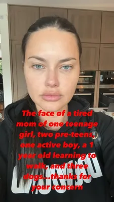 Former Victoria's Secret model Adriana Lima responds to plastic surgery  accusations