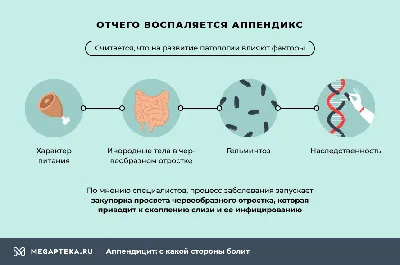 Аппендэктомия: цены на удаление аппендицита в Киеве, отзывы в клинике  Оксфорд Медикал