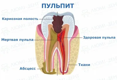 А депиляция это больно? | Пикабу