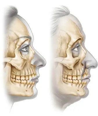 Череп иллюстрации : нормальная анатомия | e-Anatomy