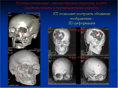 Модель черепа человека. Череп из гипса в натуральную величину, наглядное  пособие, предмет интерьера №965497 - купить в Украине на Crafta.ua