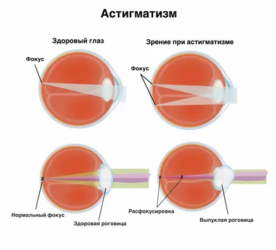 А знаете ли Вы про полезные картинки для зрения? | ВКонтакте