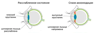 Лечение астигматизма. УПРАЖНЕНИЯ ДЛЯ ГЛАЗ при астигматизме | Восстановление  зре... — Видео | ВКонтакте