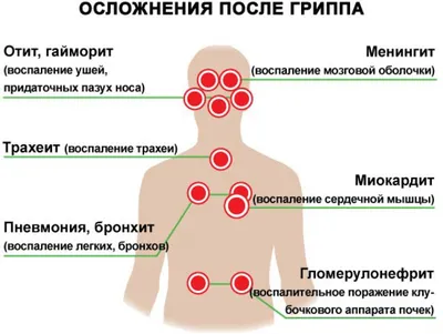 Об отличиях симптомов COVID-19 от симптомов ОРВИ и гриппа