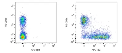 Immunoglobulin M (IgM)