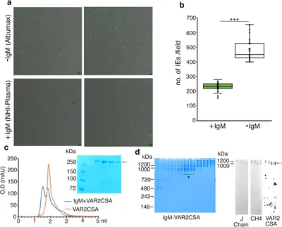 IgM-Reducing Assay Diluent